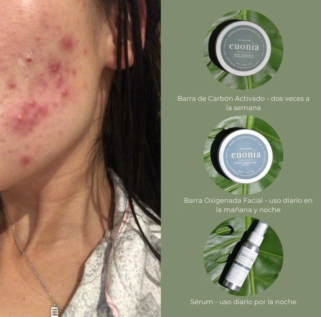 Barra Oxigenada Facial