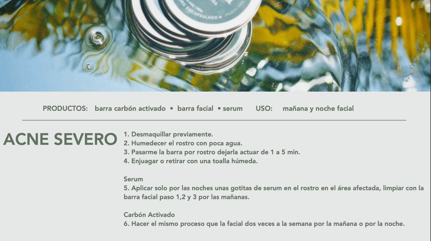 Kit Acne Severo.